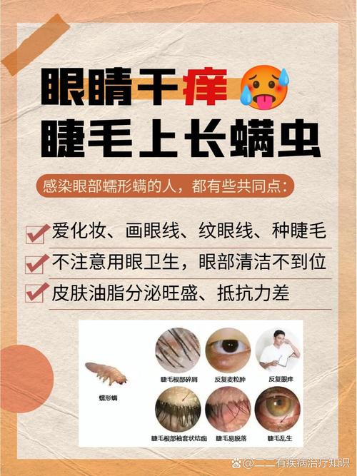 你的眼睛有螨虫吗?